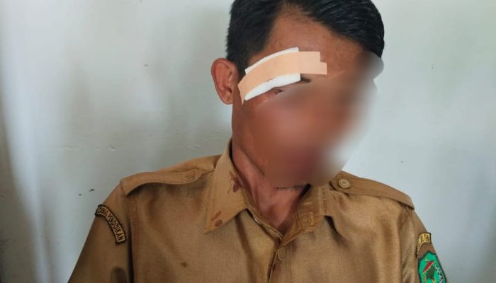 Guru SMP di Luwu Utara Diduga Dianiaya Murid Saat Jam Pelajaran, Alami Luka Robek dan Memar